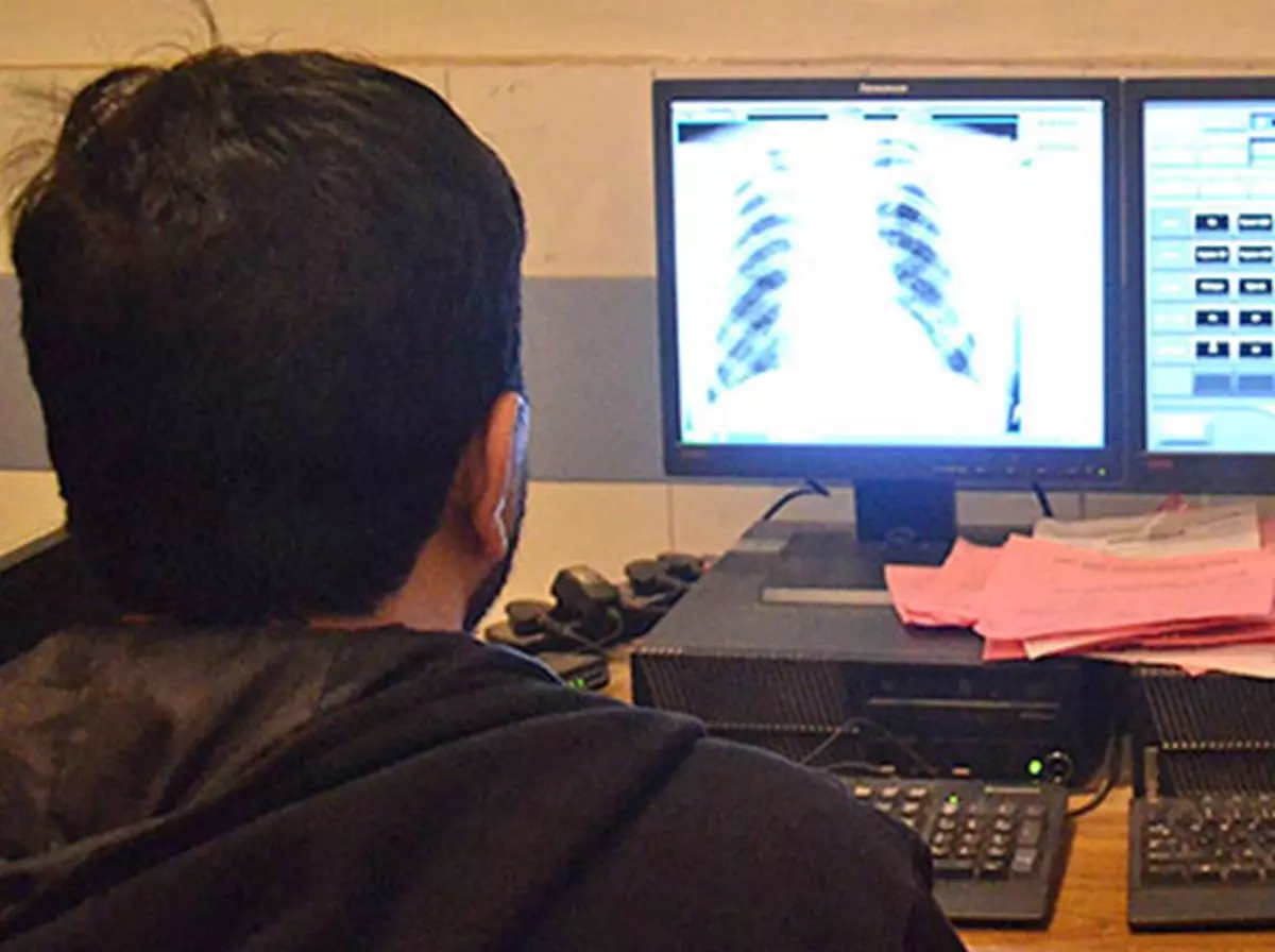 A healthcare professional looks at the X-ray of a tuberculosis patient at Kashmir’s chest diseases hospital, in Srinagar in 2015. 