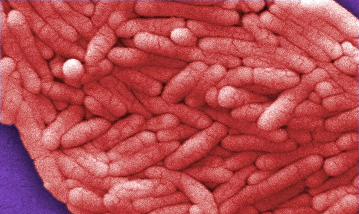 Under a very high magnification of 12000X, this undated colorized scanning electron micrograph shows a large grouping of Gram-negative Salmonella bacteria. 