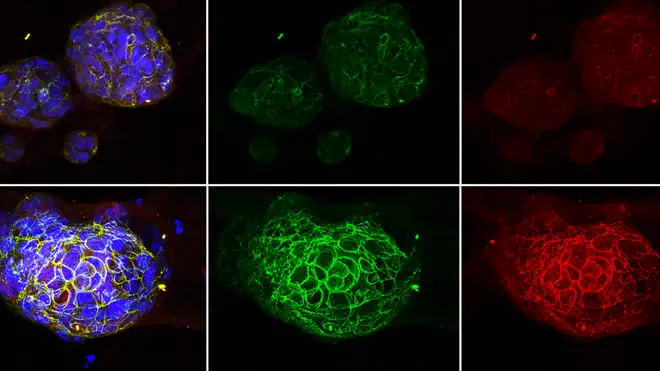 এআই ক্যান্সার স্টেম সেলকে পুনরায় প্রোগ্রাম করে, এনভিডিয়া জিপিইউ মহাকাশে পৌঁছেছে – 2025 ব্রেকথ্রু এআই ক্যান্সার স্টেম সেলকে পুনরায় প্রোগ্রাম করে, এনভিডিয়া জিপিইউ মহাকাশে পৌঁছেছে – 2025 ব্রেকথ্রু