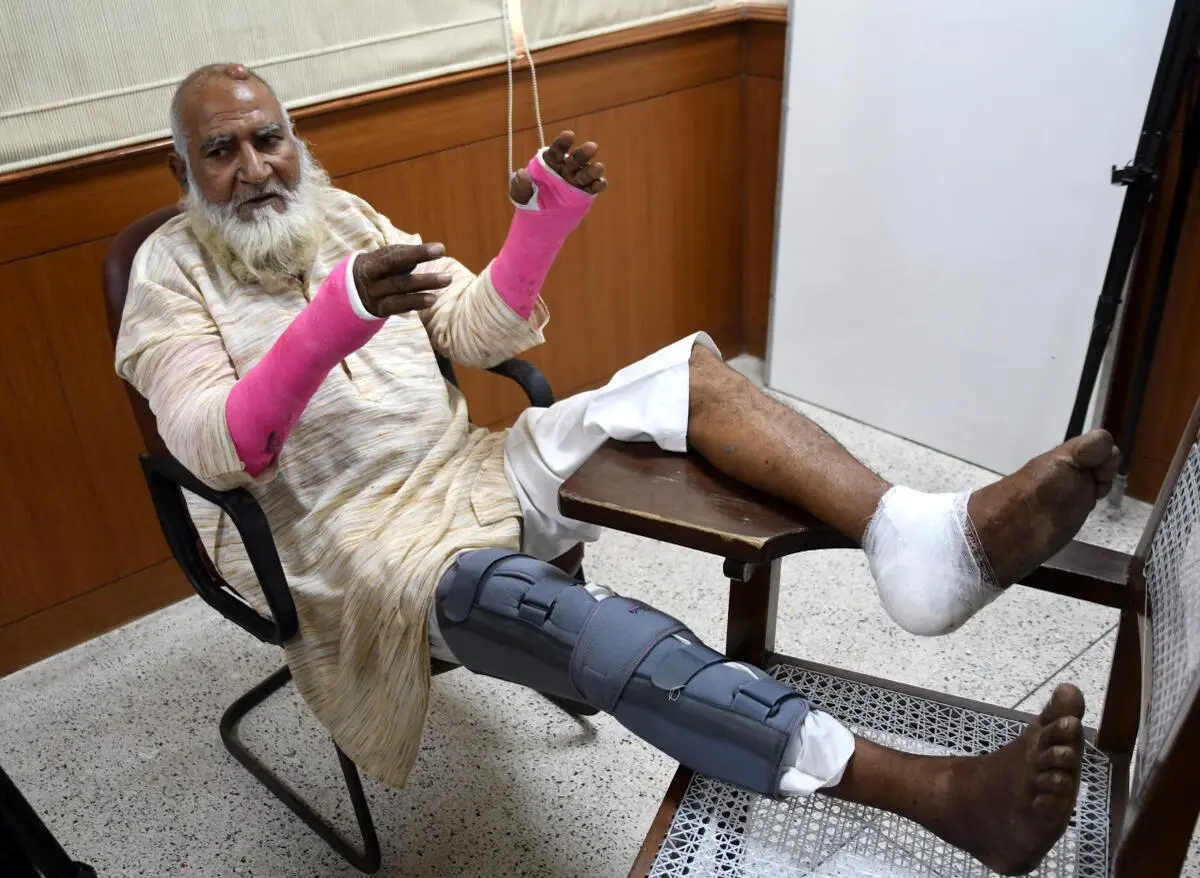 Samaydeen, pictured in July 2018, suffered fractures in both hands and right leg, and injuries near his neck after the mob lynching incident, which was driven by suspensions of cow slaughter, in New Delhi. Samaydeen, pictured in July 2018, suffered fractures in both hands and right leg, and injuries near his neck after the mob lynching incident, which was driven by suspensions of cow slaughter, in New Delhi.