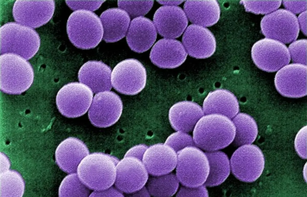 Antibiotic-resistant Staphylococcus aureas bacteria can become susceptible to antibiotics after treatment with light-activated dye molecules. 