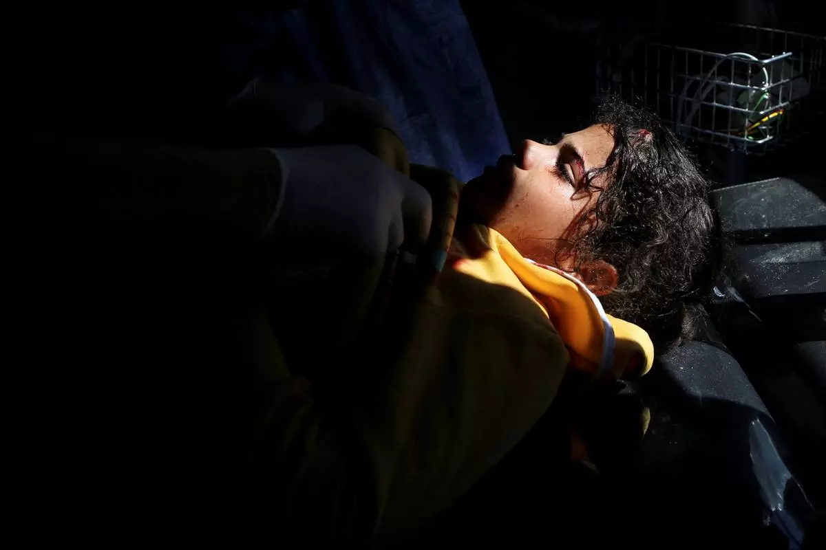 A Palestinian girl wounded in an Israeli strike is treated at a hospital as Israeli forces launch a ground and air operation in the eastern part of Rafah on May 7, 2024. 